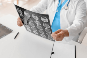 doctor looking at scans of brain